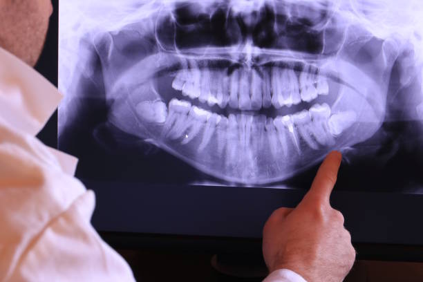 Best Emergency Dental Care for Broken or Chipped Teeth in Sioux Center, IA