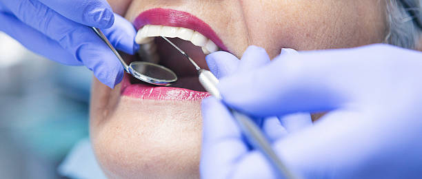 Best Emergency Tooth Extraction in Sioux Center, IA
